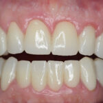 Dentin Odontólogos (Clínica Dental)foto