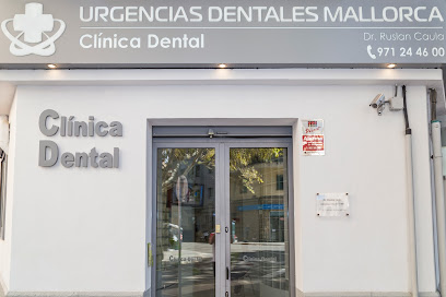 Urgencias Dentales Mallorca - Clínica Dentalfoto
